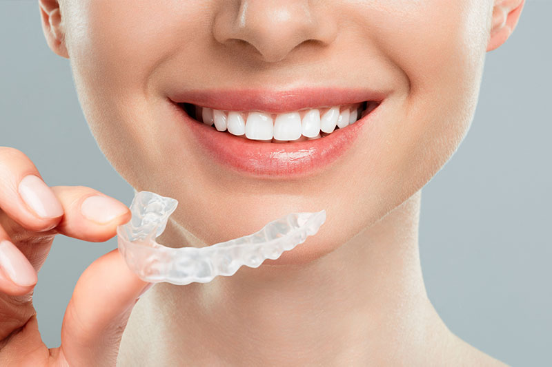 LaGrange Park Clear Aligners 